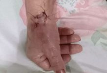 Venezolana fue apuñalada por una vecina en Argentina