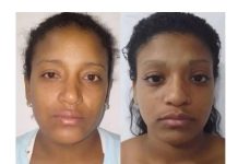 Detenidas dos mujeres en Coro por golpear a un adolescente