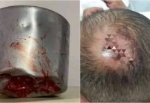 Mujer agredió a su pareja con una olla