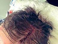 Lo hirieron en la cabeza