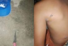 Apuñalaron a niño para robarle en medio de un apagón