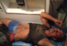 Lo arrollaron en Boca de Aroa