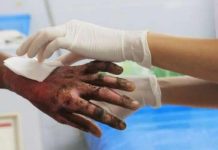 Ellos sufrieron quemaduras en La Comunidad Cardón