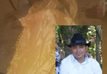 Falleció al sufrir un golpe en la cabeza en Punto Fijo