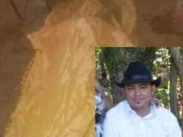 Falleció al sufrir un golpe en la cabeza en Punto Fijo