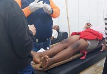 Joven dabajurense se quemó las piernas con agua caliente