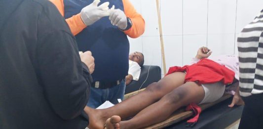 Joven dabajurense se quemó las piernas con agua caliente