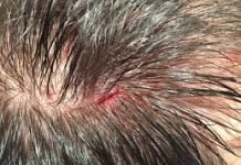 «Lo tiraron a sacar» a cabillazos en Los Taques