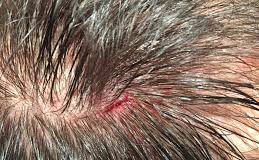 «Lo tiraron a sacar» a cabillazos en Los Taques