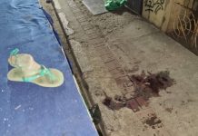 Niña de tres años sufre lesiones graves durante accidente en Churuguara