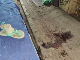 Niña de tres años sufre lesiones graves durante accidente en Churuguara