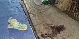 Niña de tres años sufre lesiones graves durante accidente en Churuguara