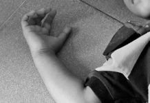 Hombre falleció por descarga eléctrica en Jacura