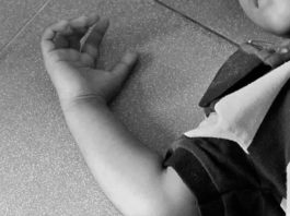 Hombre falleció por descarga eléctrica en Jacura