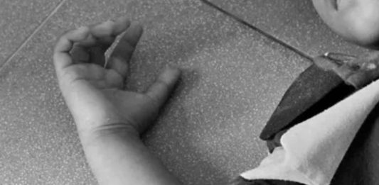 Hombre falleció por descarga eléctrica en Jacura