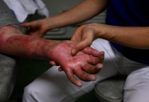 Lesionado hombre por descarga eléctrica en Mauroa