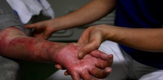 Lesionado hombre por descarga eléctrica en Mauroa