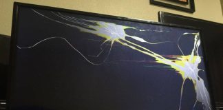 Hombre sufre quemaduras por explosión de televisión