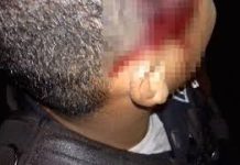 Lo lesionaron a «puño limpio» en Sabaneta