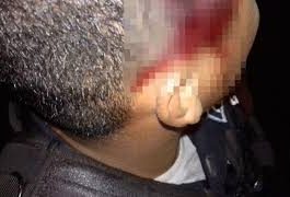 Lo lesionaron a «puño limpio» en Sabaneta