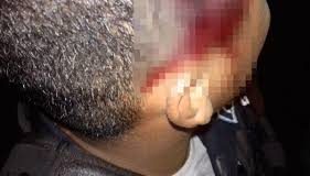 Lo lesionaron a «puño limpio» en Sabaneta