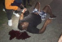 Hombre sufrió fuertes lesiones durante deslizamiento de moto en Tocuyo de La Costa