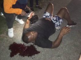 Hombre sufrió fuertes lesiones durante deslizamiento de moto en Tocuyo de La Costa