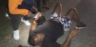 Hombre sufrió fuertes lesiones durante deslizamiento de moto en Tocuyo de La Costa