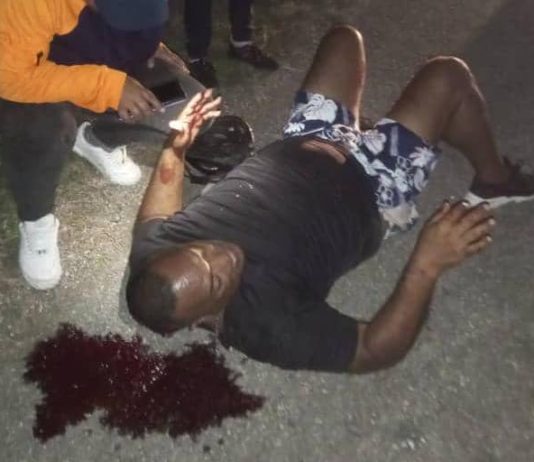 Hombre sufrió fuertes lesiones durante deslizamiento de moto en Tocuyo de La Costa