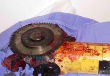 Hombre se cortó con un esmeril en Amuay