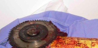 Hombre se cortó con un esmeril en Amuay