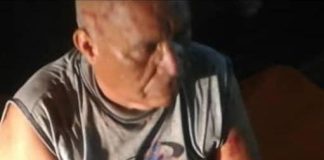 Hombre perdió dos dedos durante choque en la vía a Yabuquiva