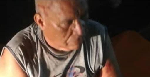 Hombre perdió dos dedos durante choque en la vía a Yabuquiva