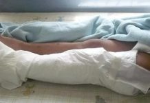 Le dieron un machetazo en la pierna en Bicentenario