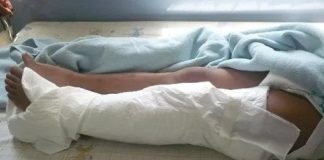 Le dieron un machetazo en la pierna en Bicentenario