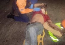 PNB lesionado al ser sorprendido por una bicicleta