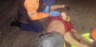 PNB lesionado al ser sorprendido por una bicicleta