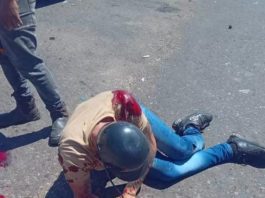 Falleció motorizado tras 24 días hospitalizado producto de una colisión