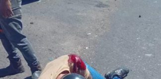 Falleció motorizado tras 24 días hospitalizado producto de una colisión