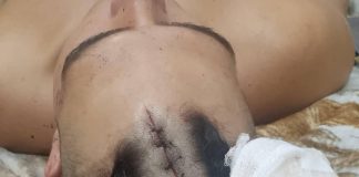 Agredió a su hermano de un machetazo en la cabeza