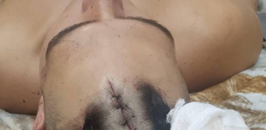 Agredió a su hermano de un machetazo en la cabeza
