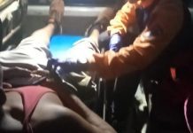 Colisionaron sus motos en Coro y este es su diagnóstico