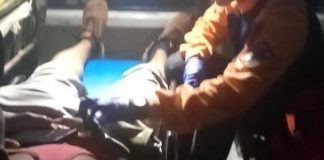 Colisionaron sus motos en Coro y este es su diagnóstico