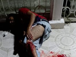 Choque entre moto y vehículo dejó dos lesionados en la avenida Paseo del Zulia