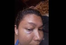 Hombre borracho y celoso golpeó a su pareja en Moruy