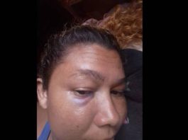 Hombre borracho y celoso golpeó a su pareja en Moruy