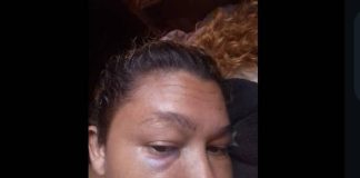 Hombre borracho y celoso golpeó a su pareja en Moruy