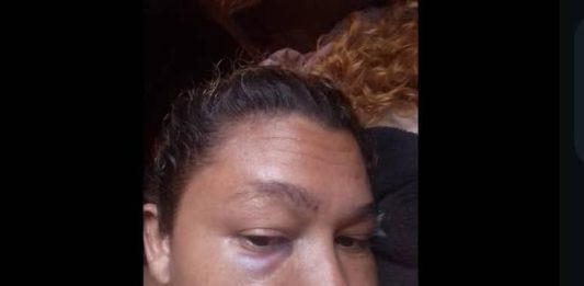 Hombre borracho y celoso golpeó a su pareja en Moruy
