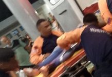 Motorizado sufrió un traumatismo craneoencefálico complicado en Coro