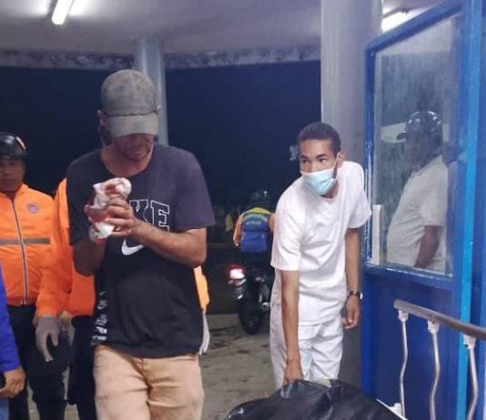 Hombre sufrió una herida en la mano con una arma blanca en Coro